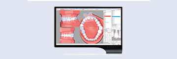 planing-extern